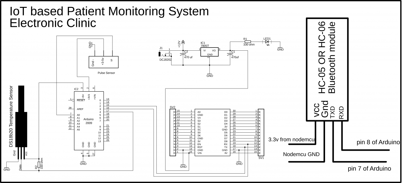 IoT based Patient monitoring System